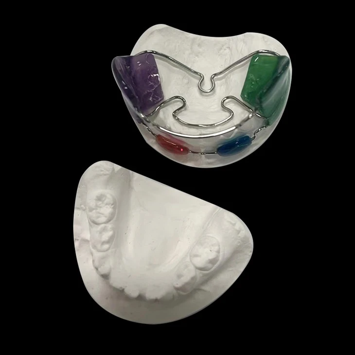Frank Removable Denture